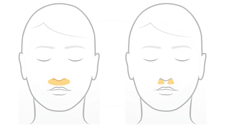 Fisher & Paykel Solo Neuskussen-CPAP-masker